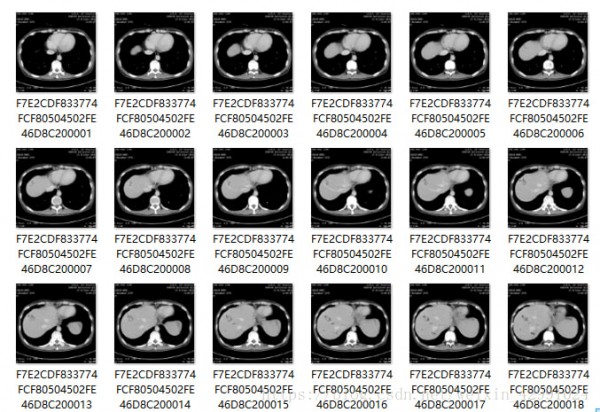 MicroDicom viewer(Dicom格式看圖軟件)