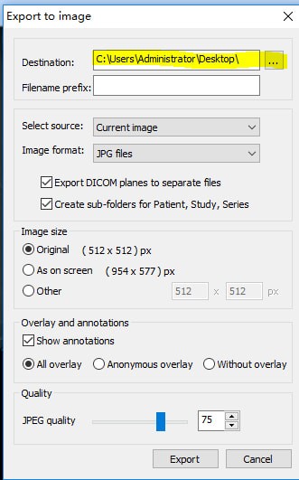 MicroDicom viewer(Dicom格式看圖軟件)